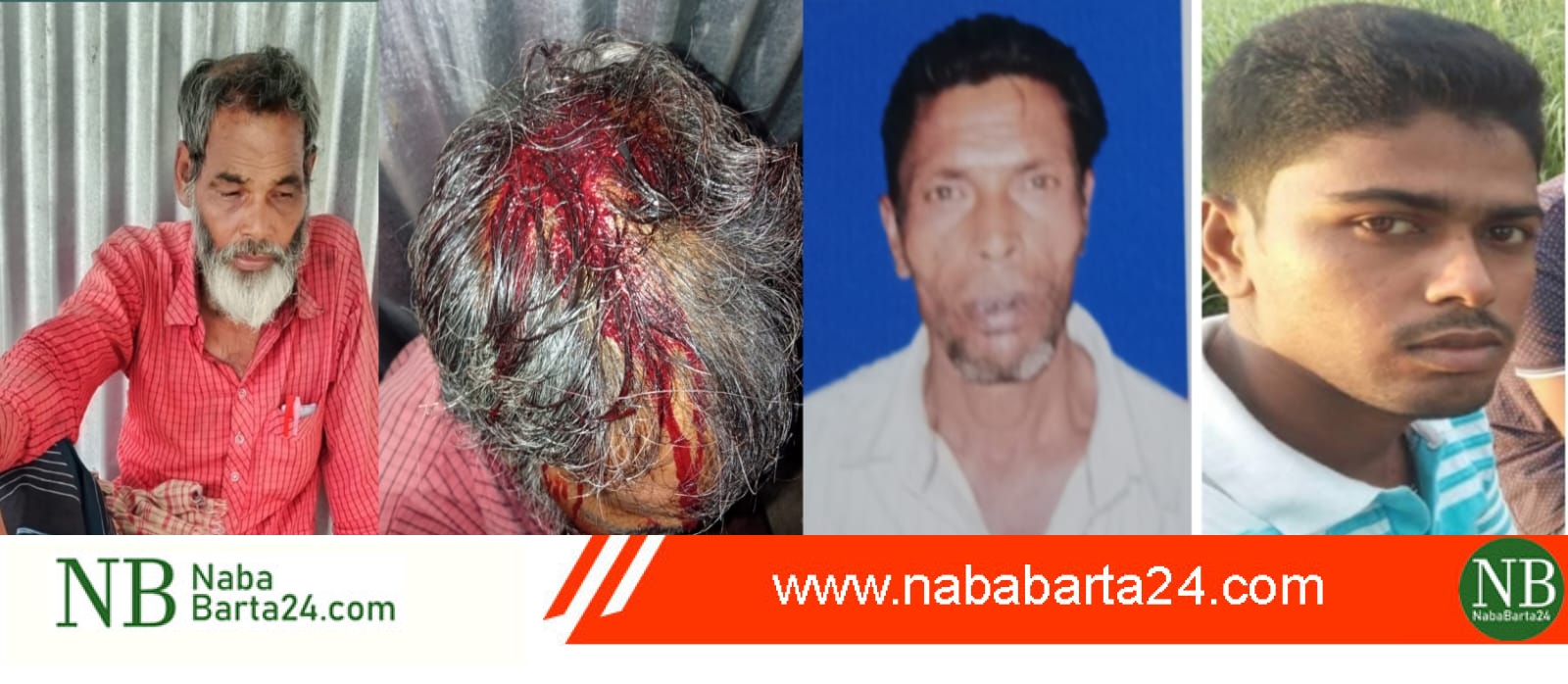 মধুখালীতে পাগল মেরে হাসপাতালে পাঠিয়েছে পিতা পুত্র ,মাথায় আটটি সেলাই